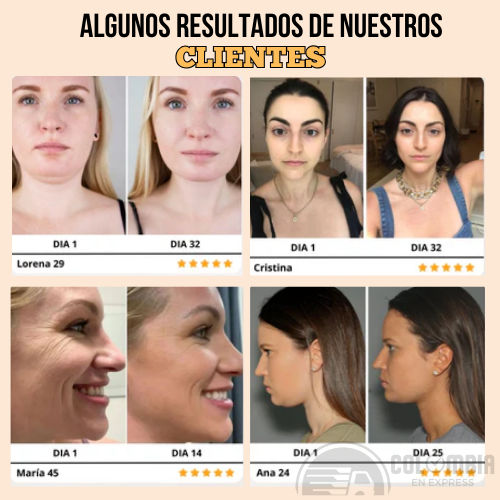SkinTone - Masajeador facial microcorriente ✨