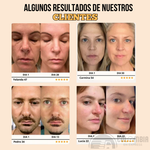 SkinTone - Masajeador facial microcorriente ✨